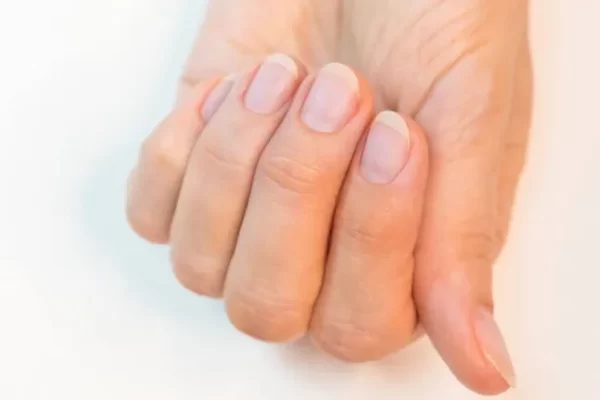 5 tips to strengthen your nails Beautiful, clear, healthy simple